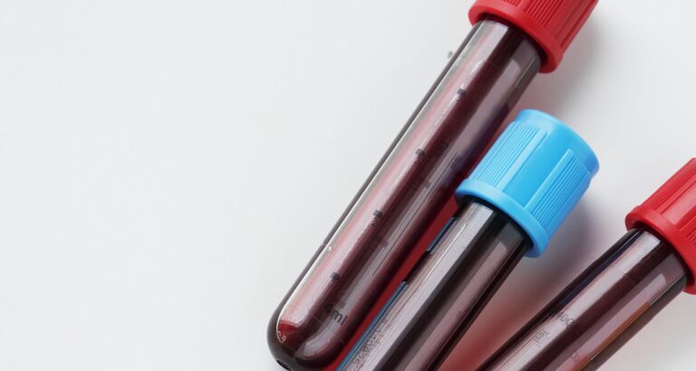 Reagensglas med blod